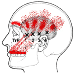 trigger point 16-10-25